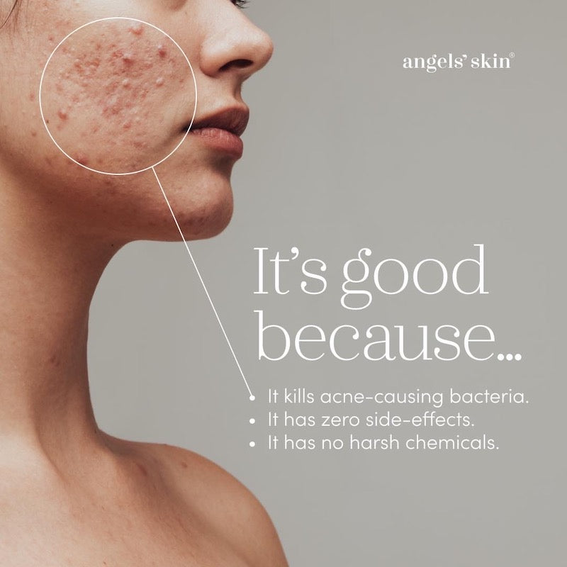 Angels' Skin Vitamin Enriched Probiotic Day & Night Cream